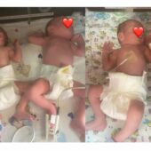 Перша трійня в Україні цьогоріч народилася в Ужгороді