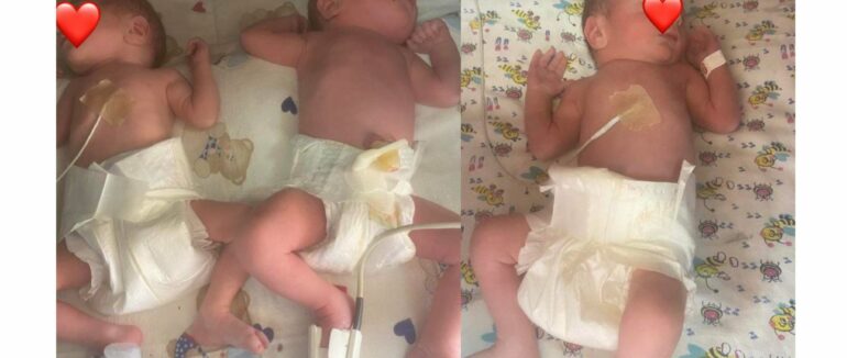 Перша трійня в Україні цьогоріч народилася в Ужгороді