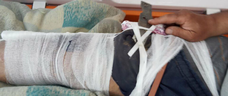 На Берегівщині чоловік пошкодив ногу під час польових робіт