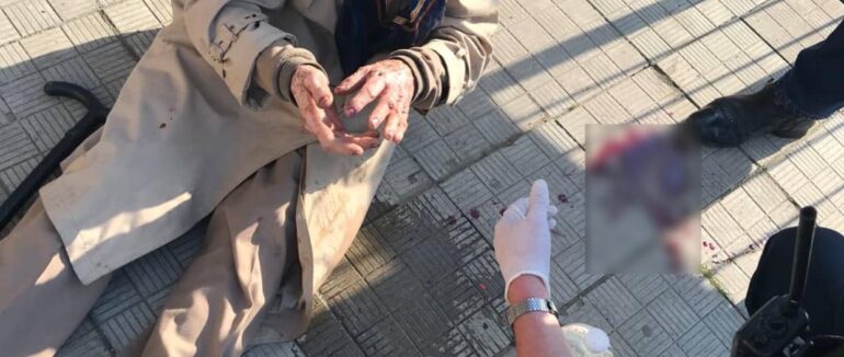 Патрульні в Ужгороді надали допомогу двом літнім жінкам, яким стало зле