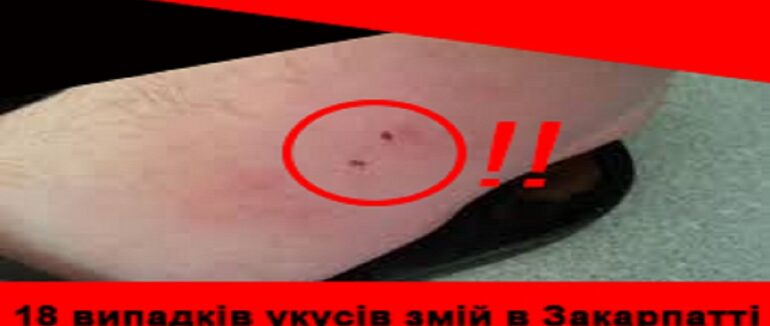 На Закарпатті зафіксовано 18 випадків укусів змій