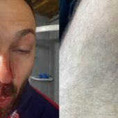 Побили іноземця: за що у Солотвині пара фіктивних правоохоронців напала на чоловіка? (ФОТО)