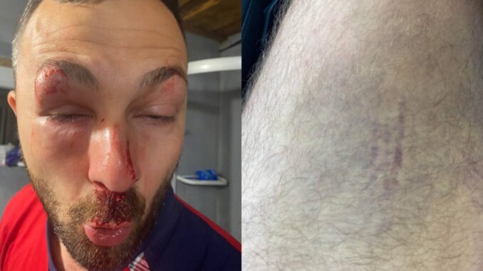 Побили іноземця: за що у Солотвині пара фіктивних правоохоронців напала на чоловіка? (ФОТО)