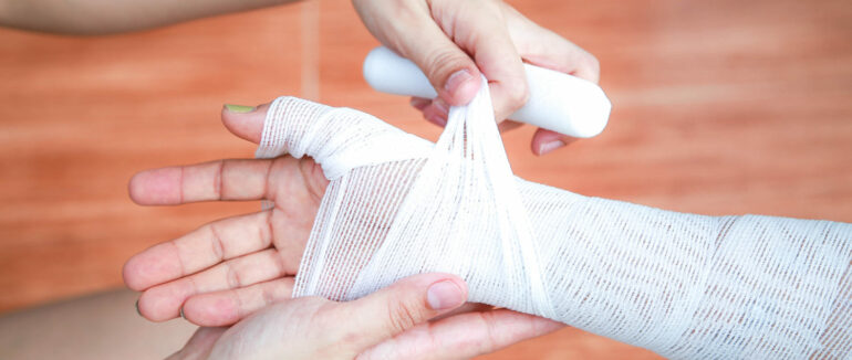 Двоє людей отримали опіки внаслідок пожеж на Тячівщині