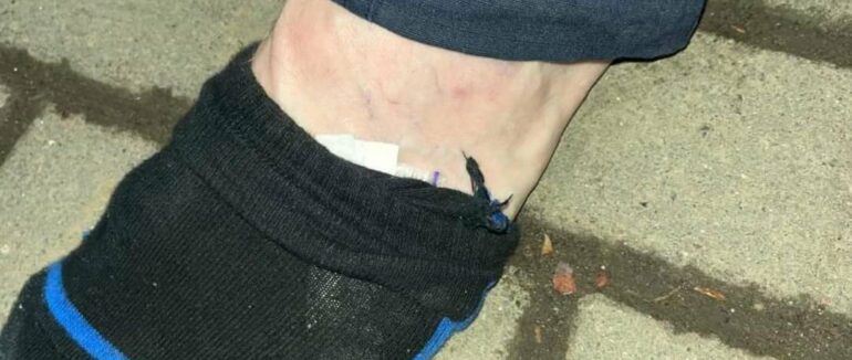 У шкарпетці заховав наркотики: на Закарпатті затримали порушників