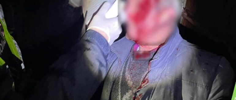 Вночі в Ужгороді психічнохворий чоловік побив батька (ФОТО 18+)