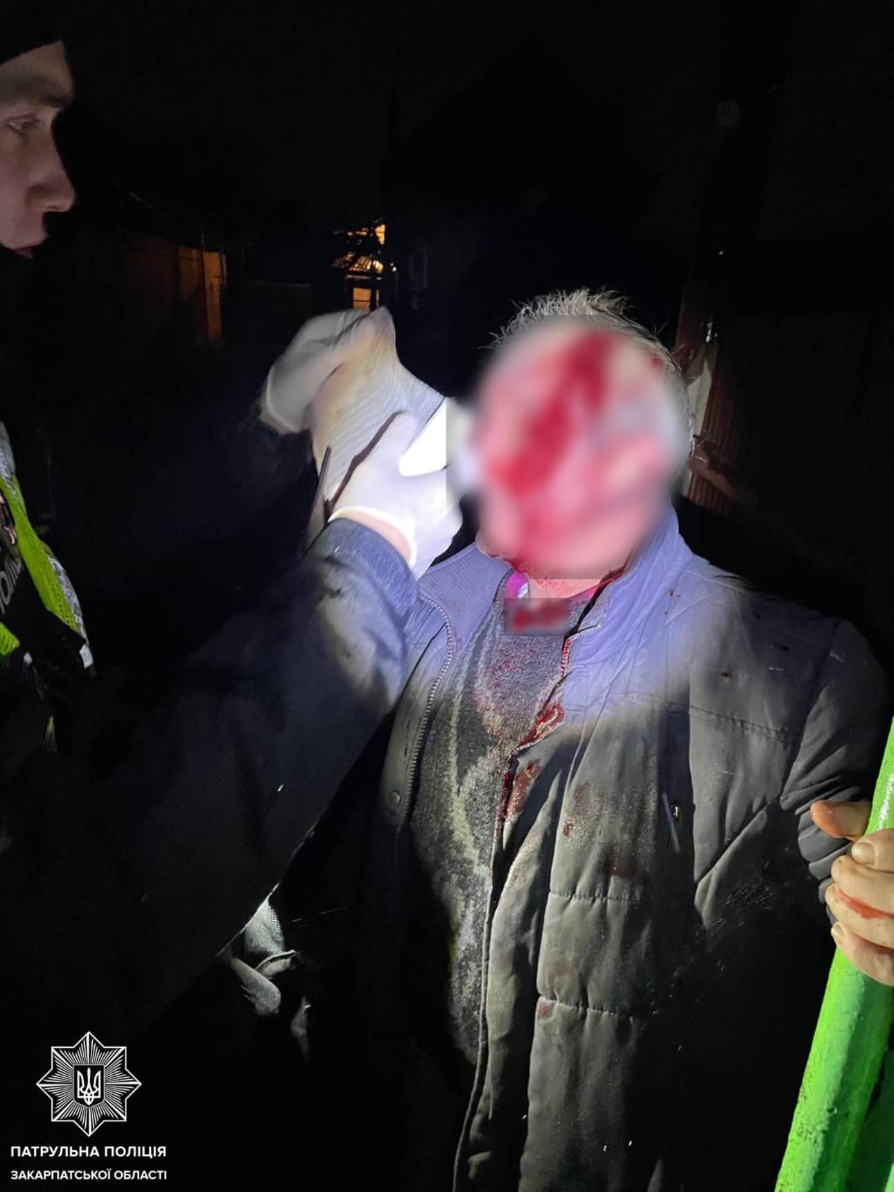 Вночі в Ужгороді психічнохворий чоловік побив батька (ФОТО 18+)