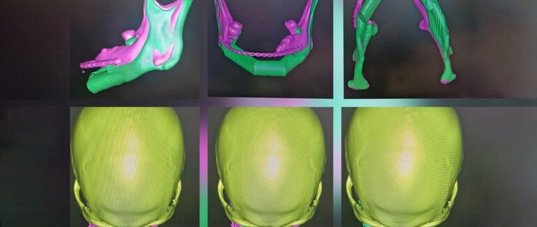 На Закарпатті вперше провели реконструкцію обличчя