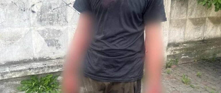 Бійка між ужгородцями: в Ужгороді затримали чоловіків зі зброєю