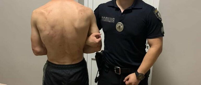 27-річний п’яний мукачівець поводився неадекватно та розбив вікно училища: його затримали