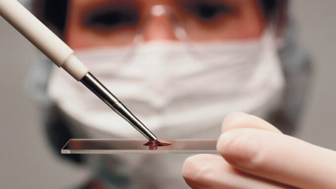 Закарпатців просять терміново здати кров