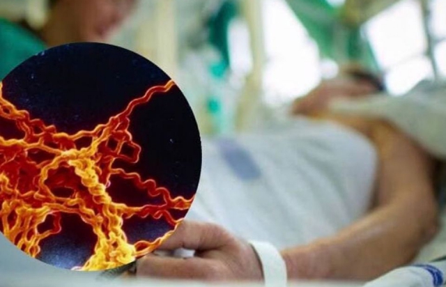 Минулоріч на Закарпатті від лептоспірозу померло 15 людей