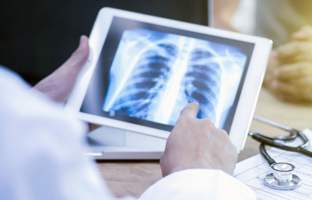 На Закарпатті зростає захворюваність на туберкульоз серед дітей