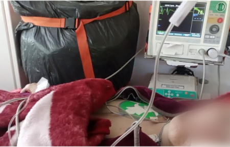 На Закарпатті медики екстренки врятували життя  жінці