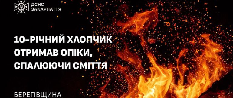 На Берегівщині 10-річний хлопчик отримав опіки під час спалювання сміття