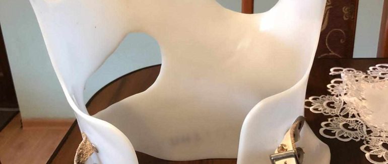 Біль не дає спокійно жити: історія хвороби та 6 років страждань закарпатки Герзанич Владислави