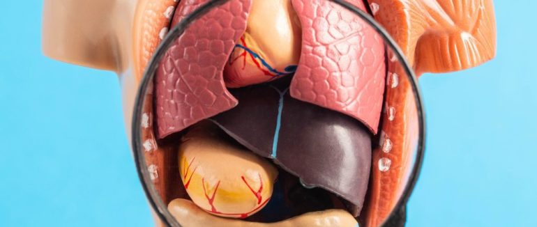 Хірург пояснив чому в жовчному міхурі утворюються камені