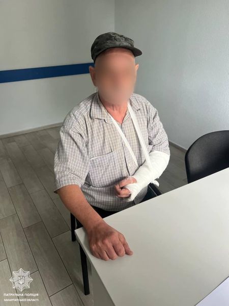 В Ужгороді затримали громадянина, який побив іншого