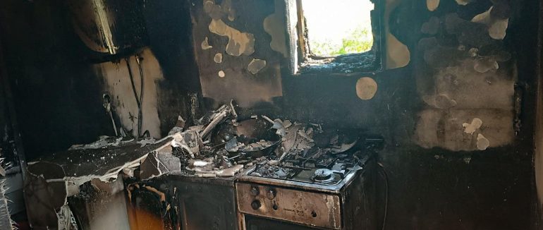 На Берегівщині під час пожежі чоловік отримав опіки