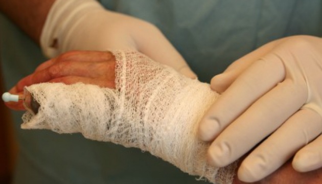 Через загоряння трави до лікарні з опіками потрапила 80-річна закарпатка