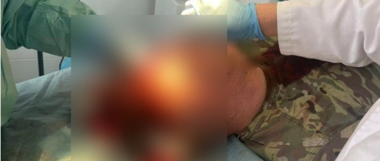 У Великому Березному група місцевих жителів напала на прикордонників: двоє поранених