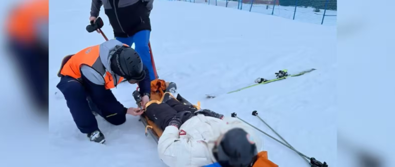 Впав під час катання і розбив голову: на Красії евакуювали лижника