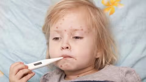 На Закарпатті зростає захворюваність на кір: більшість хворих – нещеплені діти