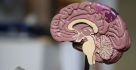 Деменція ропочинається непомітно: 7 симптомів, які не можна ігнорувати