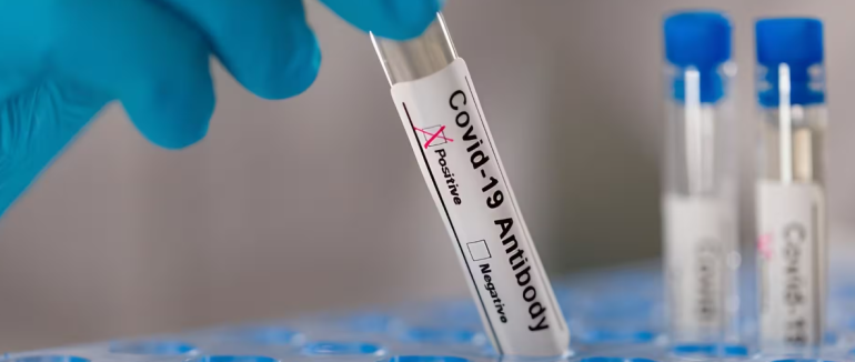 В Україні зафіксували перший випадок субваріанту COVID-19 «Цикада»