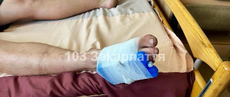 На Закарпатті 21-річного чоловіка госпіталізували після укусу гадюки