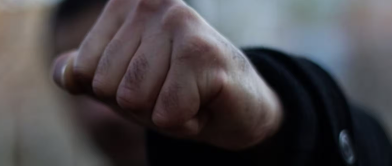 В Ужгороді сталася масова бійка: серед постраждалих — 16-річна дівчина